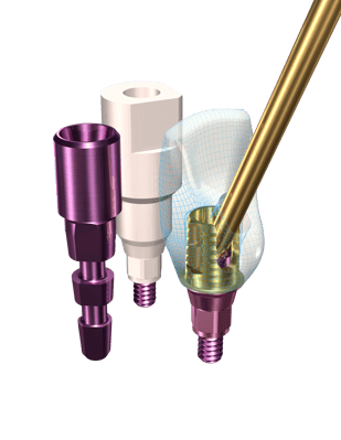 direct dental implant