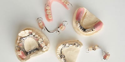 removable partial dentures