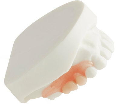 partial denture plex on model