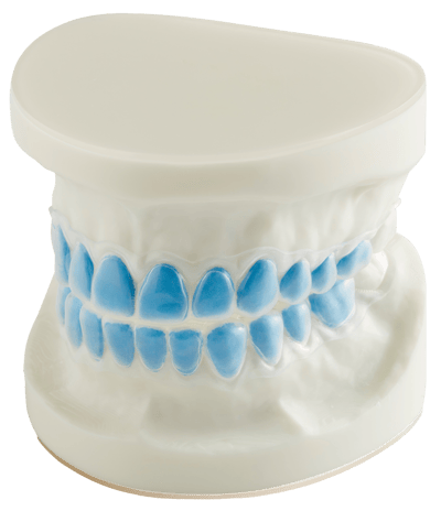 bleaching trays for upper and lower