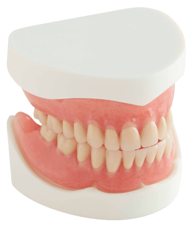 Full Acrylic Dentures