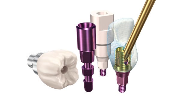 direct implant bundle