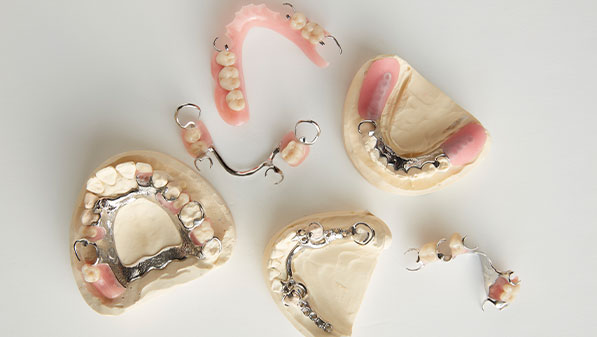 Removable Prosthodontics | Partial Dentures | Upper Partial Dentures