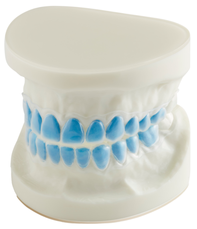bleaching trays for upper and lower