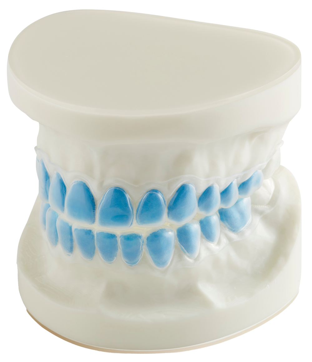 Dental Bleaching Trays Southern Cross Dental
