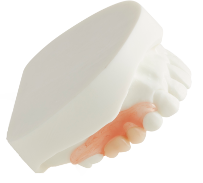 partial denture plex on model