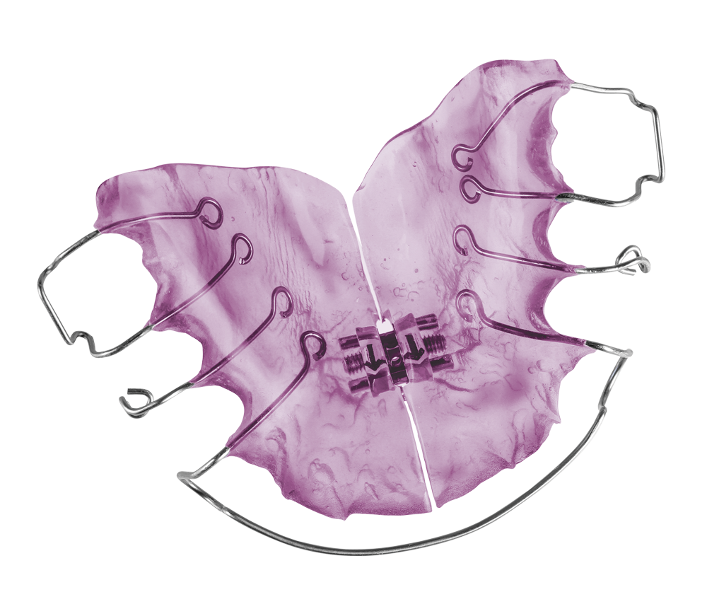 Orthodontic Appliances & Retainers Southern Cross Dental