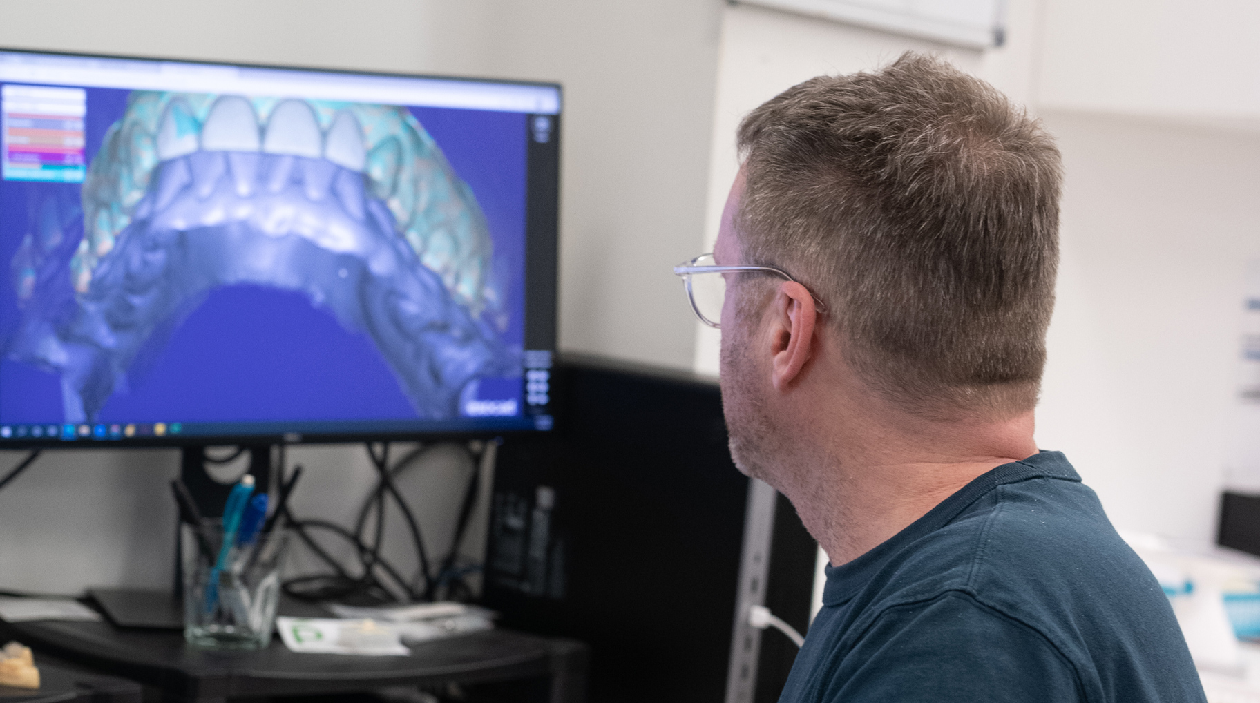 Sending Impressions via Sirona CEREC Digital Scanners Southern Cross